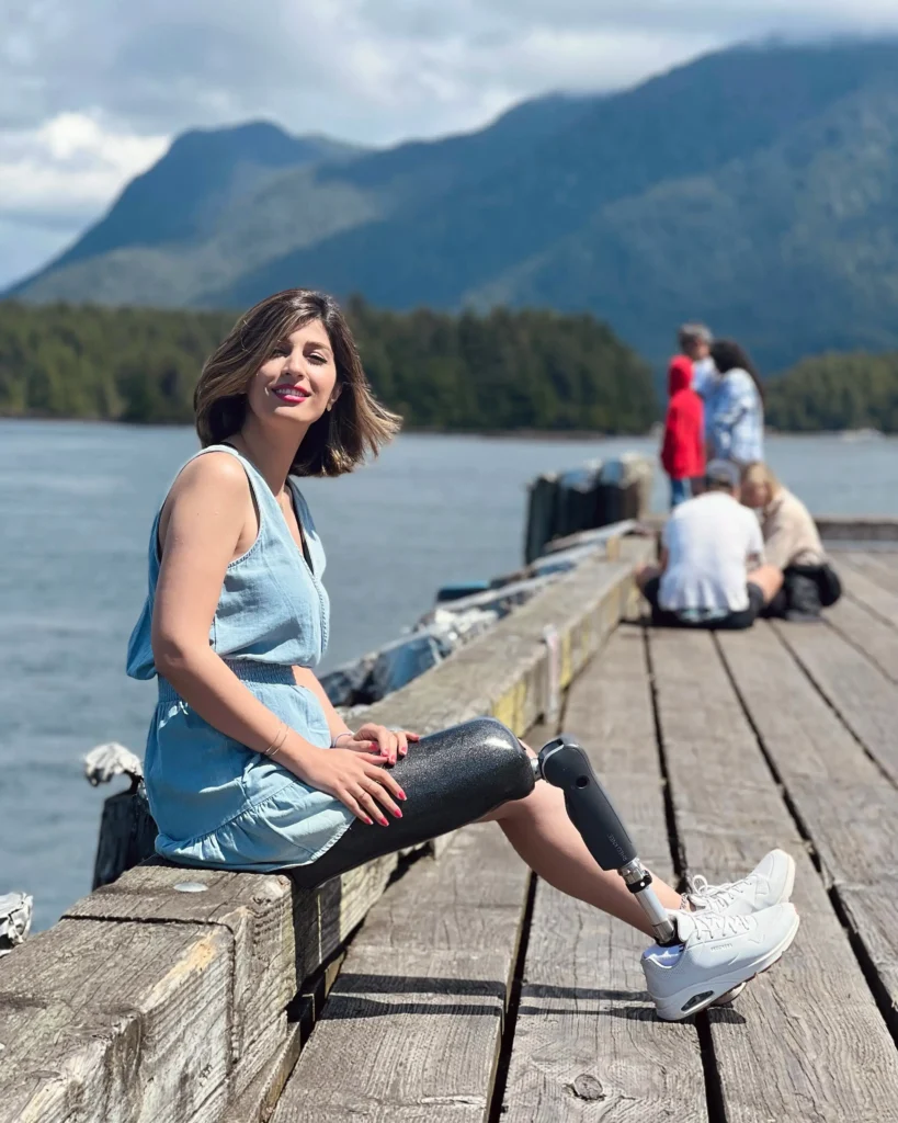 A woman in a light blue denim dress sits on the edge of a weathered wooden dock, smiling toward the camera. She is wearing a sleek, dark grey prosthetic leg and white sneakers. The background shows a large body of water with misty, blue-toned mountains in the distance and a few blurred figures walking further down the dock.