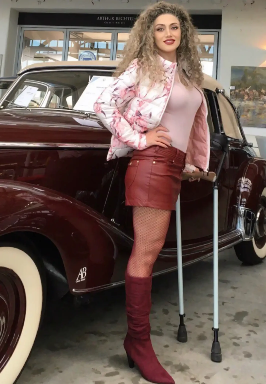 Woman with long, curly hair posing beside a vintage dark-coloured car, wearing a pink floral jacket, fitted top, short skirt, patterned tights and knee-high boots, standing with the support of forearm crutches inside a showroom space.