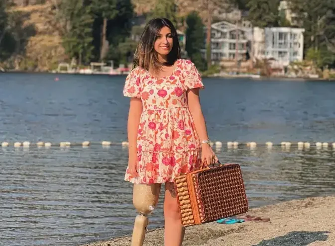 A woman stands on a sandy beach smiling, wearing a floral pink and white dress and holding a large woven picnic basket. Her prosthetic leg is visible beneath the hem of her dress. Behind her is a calm lake and a steep hillside dotted with houses and lush green evergreen trees.