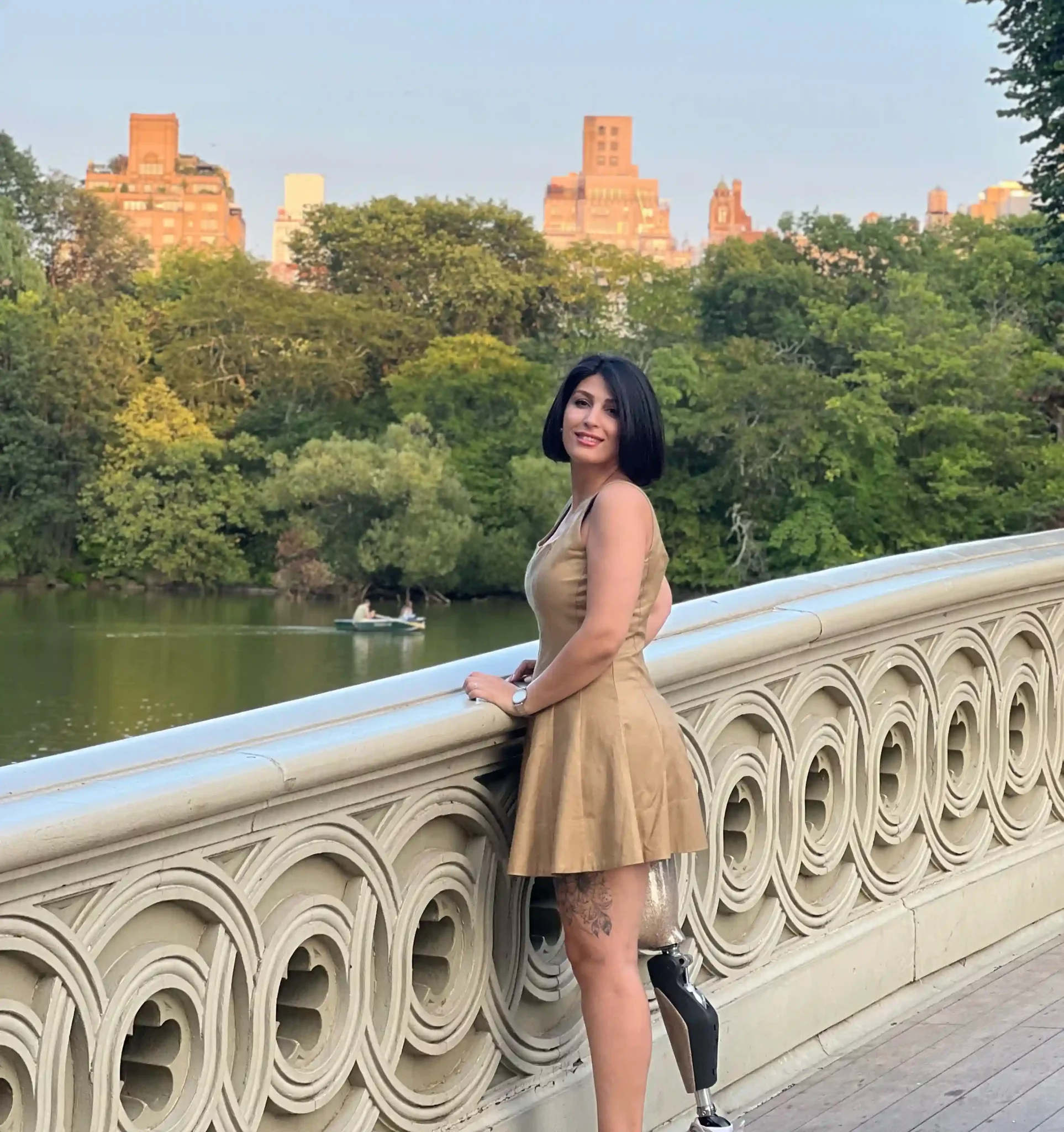 Woman standing on an ornate bridge overlooking a calm lake and green park, wearing a sleeveless gold-toned dress, with a visible prosthetic leg, city buildings rising above the trees in the background during golden-hour light.